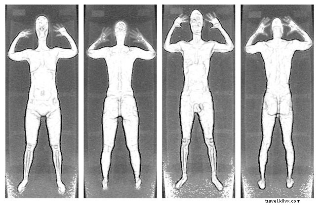 TSA Airport Security: Snow Globes, Body Scanners, Health Risks, and Pat-Down Experiences