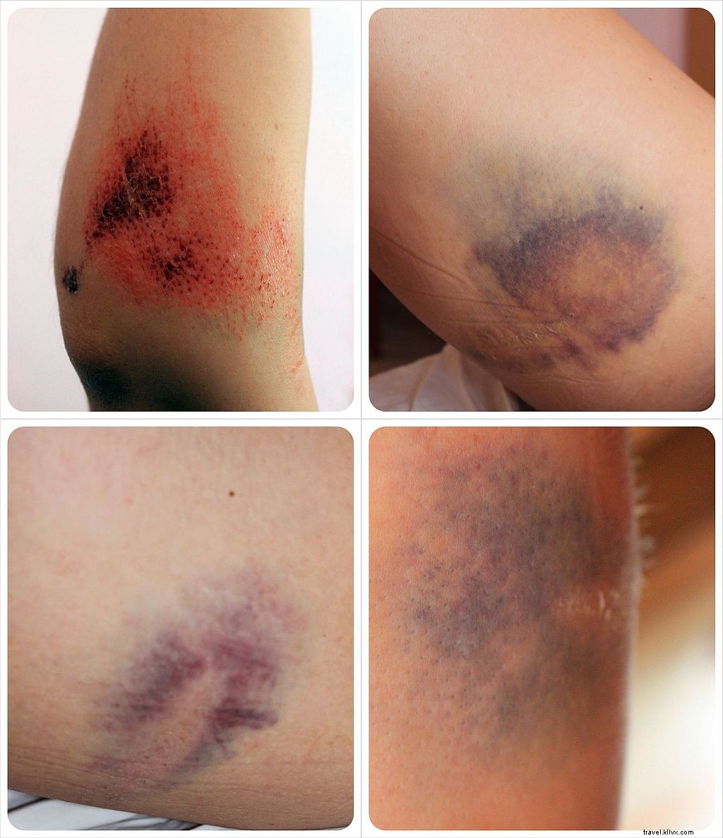 Rammed by a Cow in Goa: A Traveler s Shocking Encounter and Swift Recovery in India