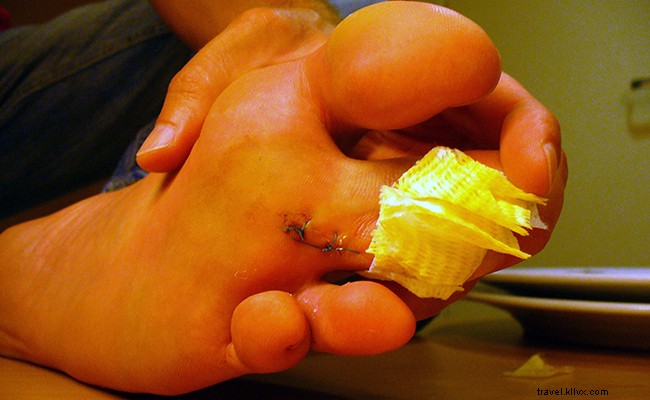 Mastering Travel Insurance: Lessons from 13 Years of Global Adventures