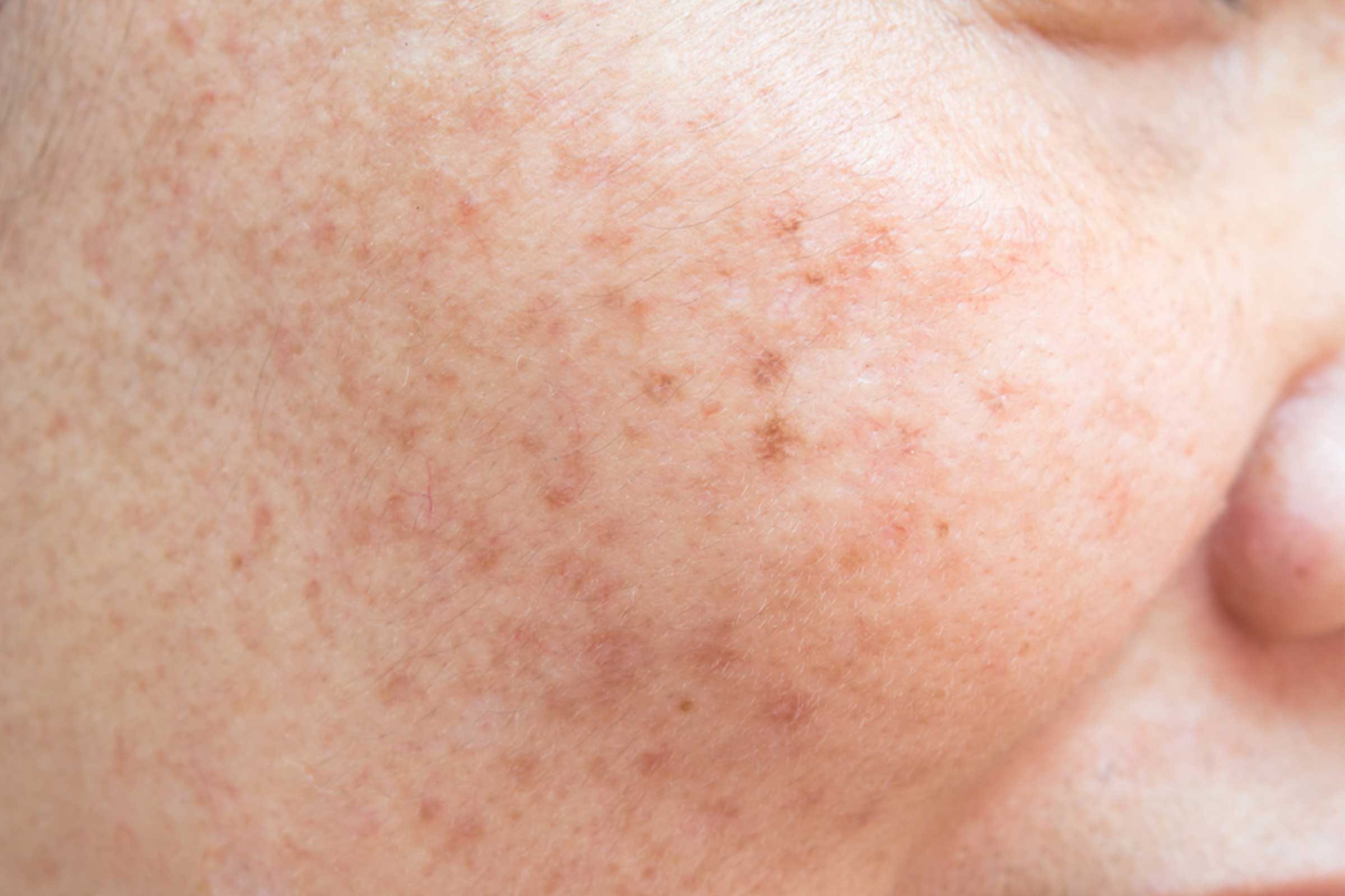 22 Must‑Do Summer Activities Before the Season Ends